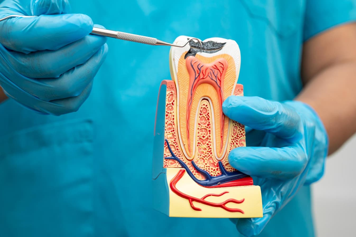 Comfortable root canal treatment being performed at Rancho Bernardo Dental Arts
