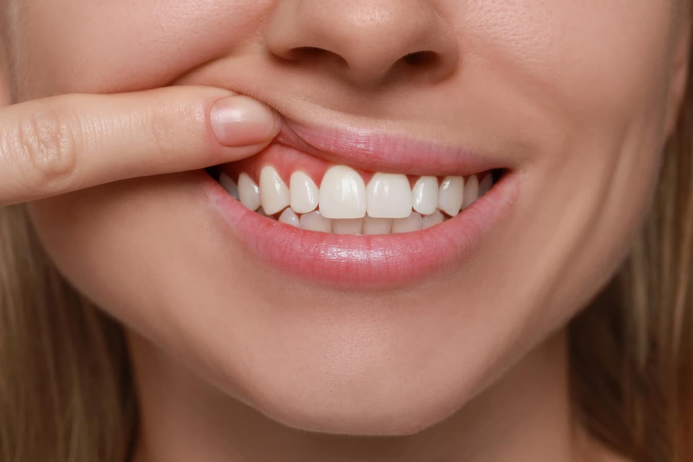 Arestin antibiotic being placed into a gum pocket at Rancho Bernardo Dental Arts