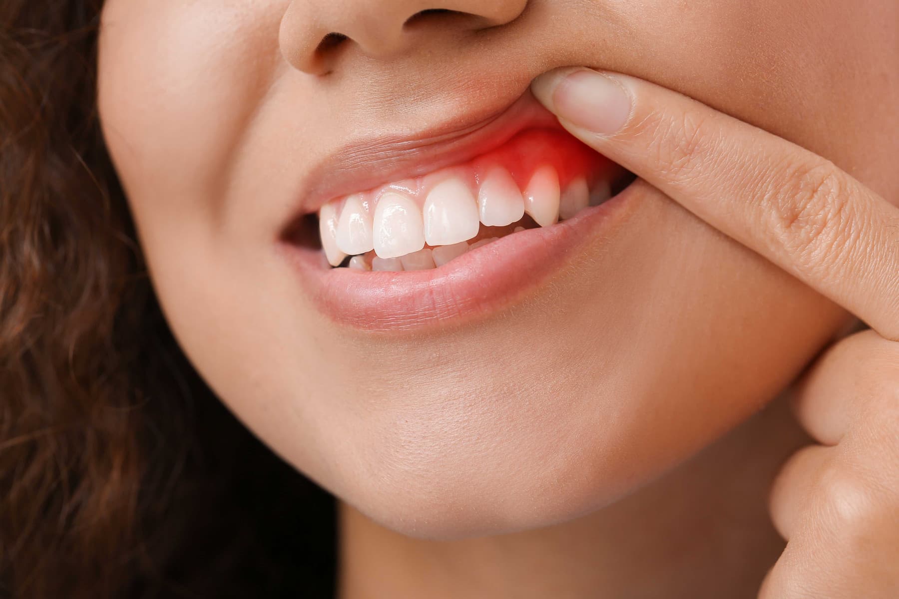 Hygienist treating early gingivitis at Rancho Bernardo Dental Arts in San Diego