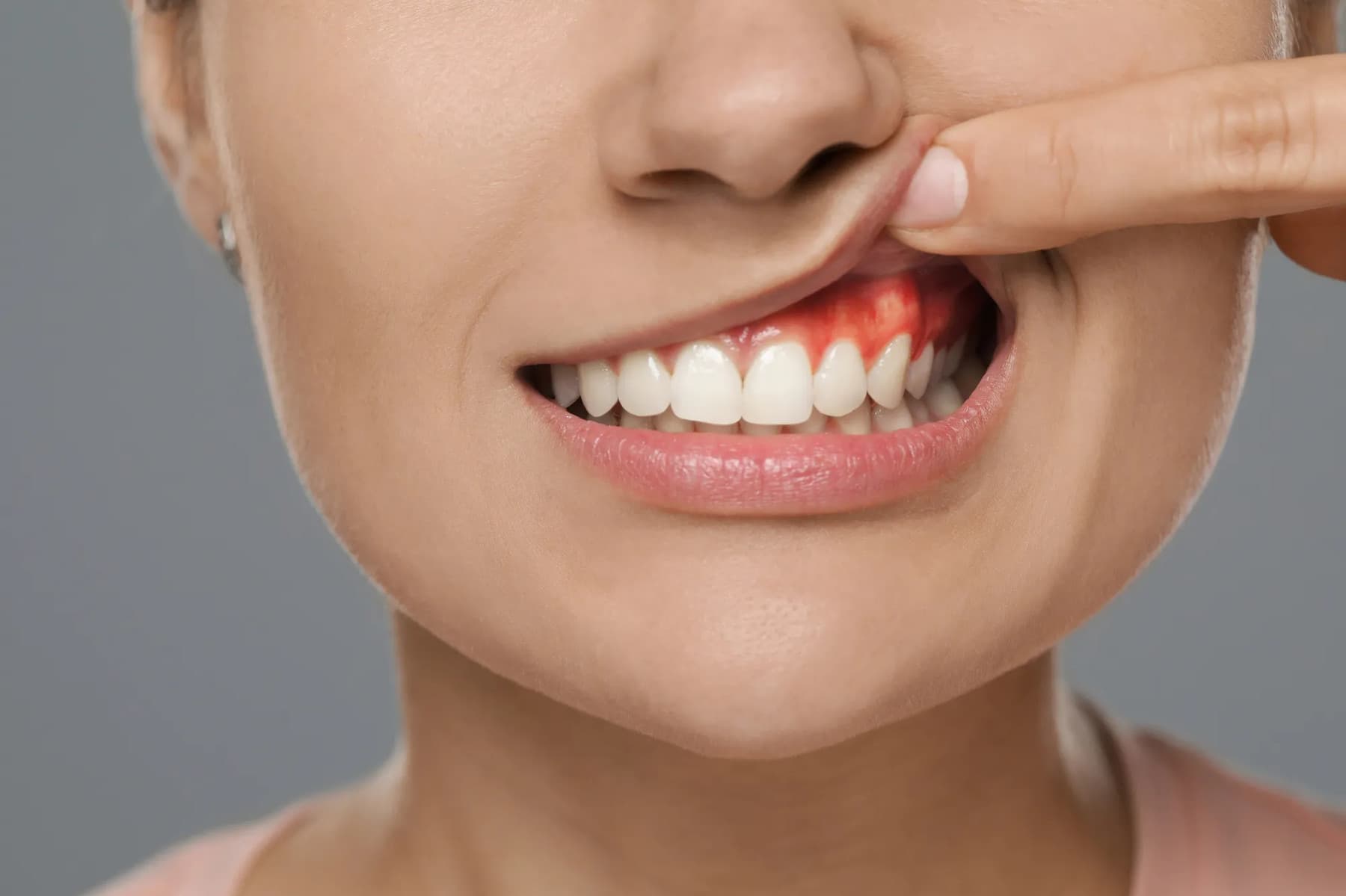 Comprehensive gum disease treatment at Rancho Bernardo Dental Arts in San Diego