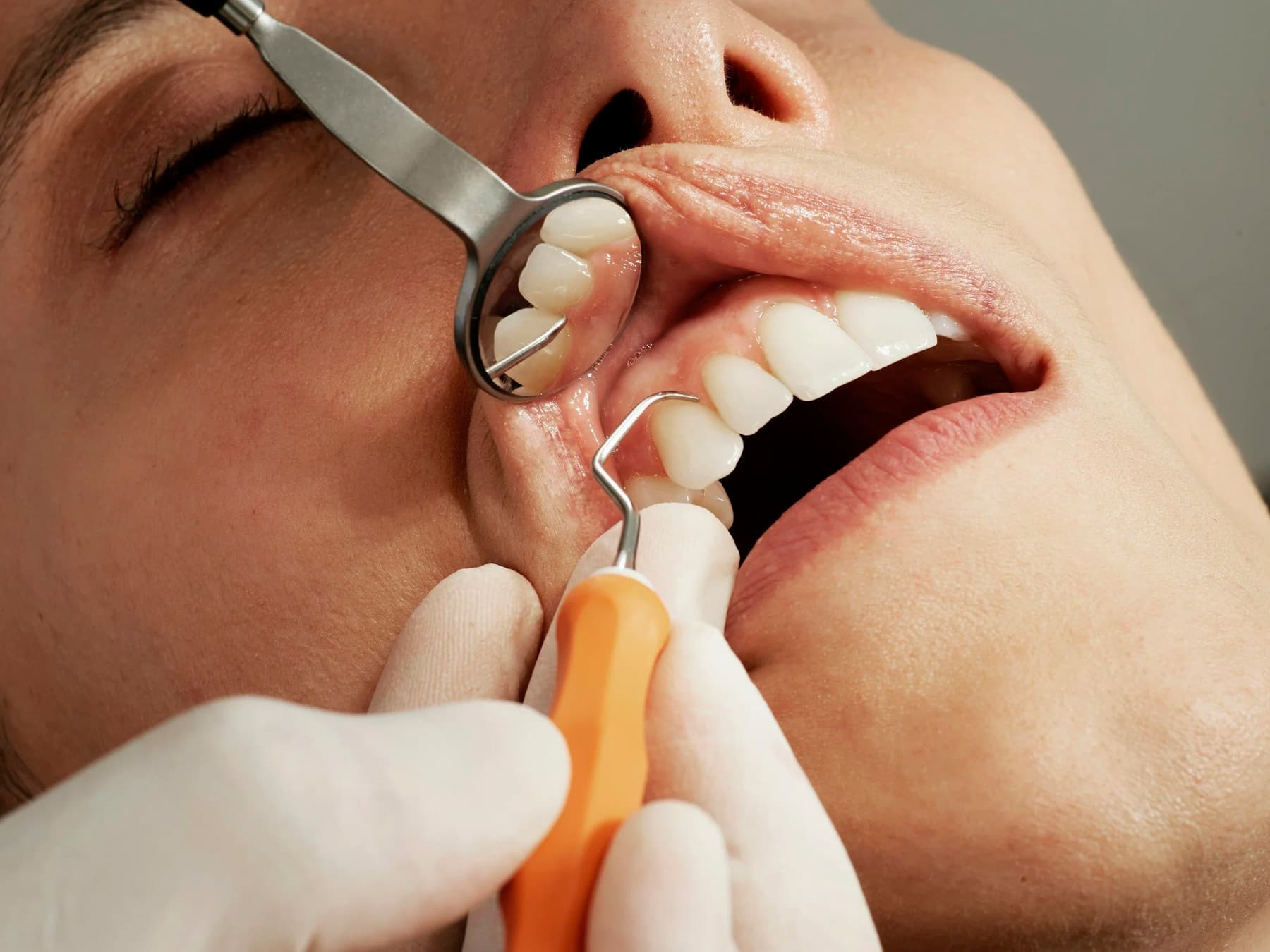 Hygienist explaining prophy versus periodontal maintenance at Rancho Bernardo Dental Arts