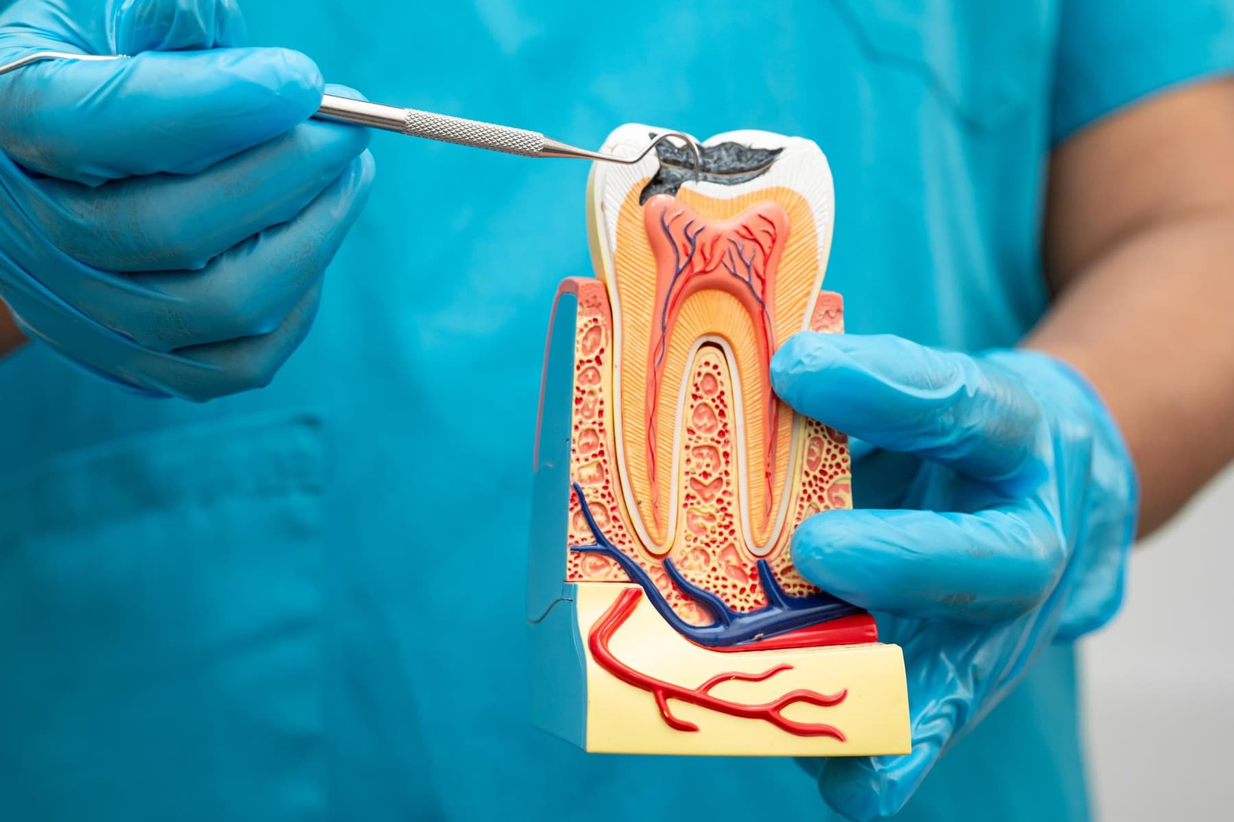 Comfortable root canal treatment being performed at Rancho Bernardo Dental Arts